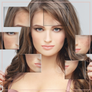 IPL Photofacial for Radiant Skin BlossomMD-East-Bay-California